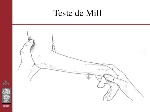 TESTE DE MILL