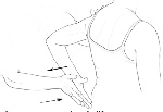 Subescapular